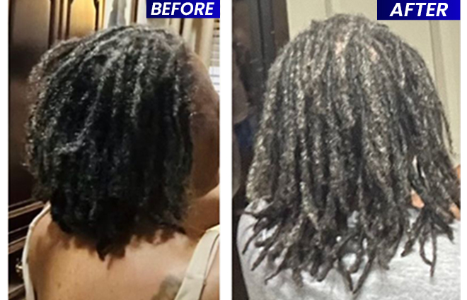 new pics before after 02