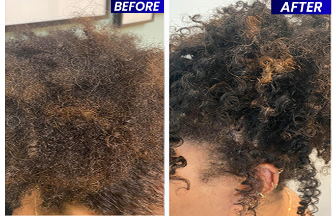 new pics before after 11